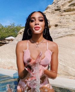 Winnie Harlow